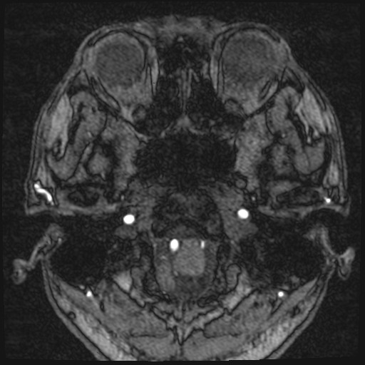 Click on the Serie image to view the images of VILLANUEVA, WILLIAM A.